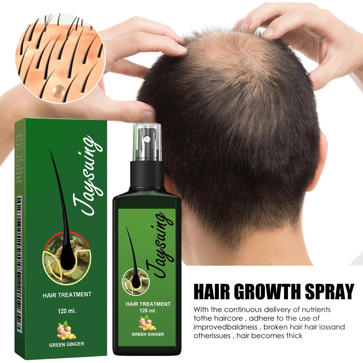 Ginger Hair Growth Spray – Scalp Nourishing Treatment for Thicker, Healthier Hair