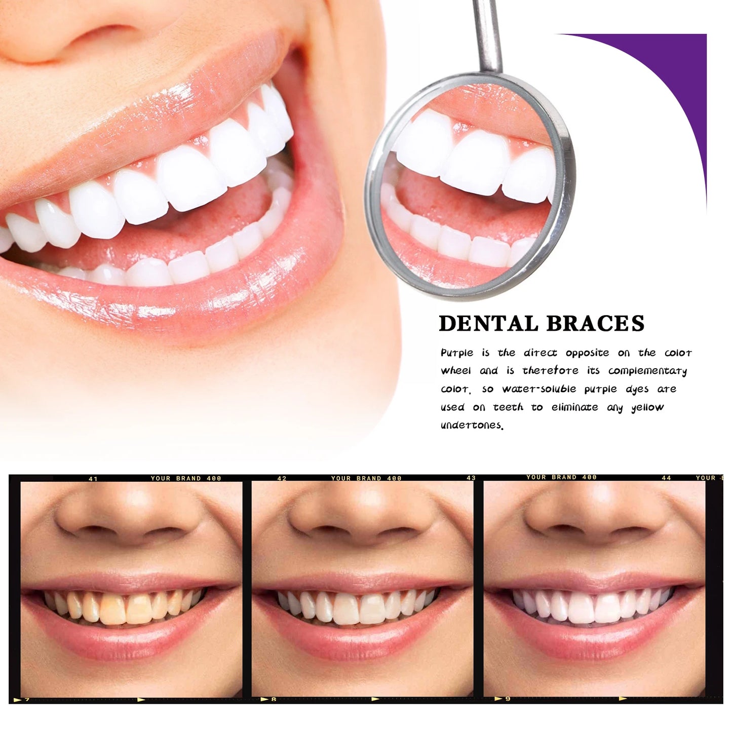 Say Goodbye to Yellow Teeth in Minutes – V34 Whitening Boost for a Brighter Smile!”